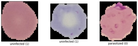 malaria-1.0.0a
