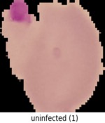 malaria-1.0.0c
